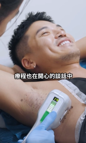 miraDry 療程紀錄影片畫面二